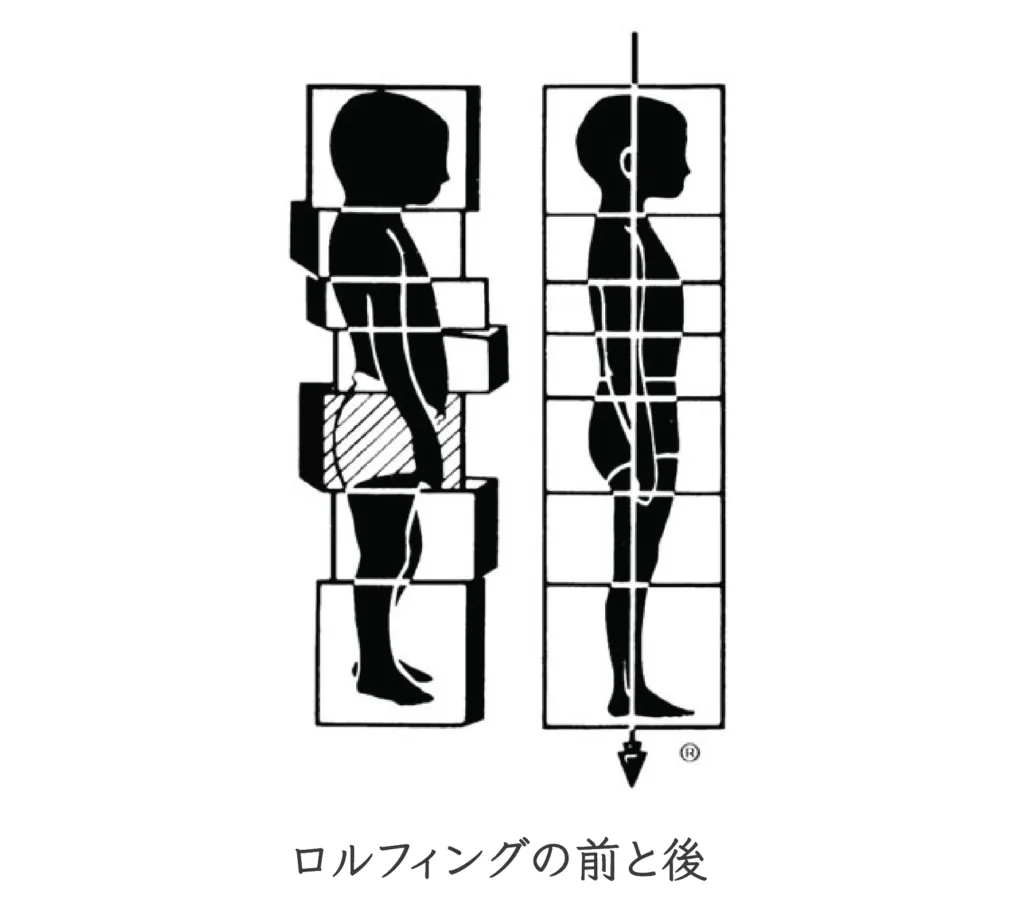 効果が長続きして元に戻りにくい「ロルフィング」